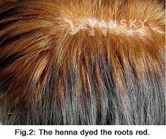 250219140400_Hair-Dying with henna-s.jpg